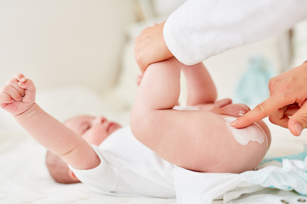 Les bons gestes pour prévenir et soigner l'érythème fessier du bébé